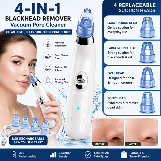 Instant Blackhead Remover Vacuum – Deep Clean Pores in Minutes | 4-in-1 Skin Tool